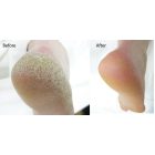 FOOTLOGIX BELÉPŐ PEDIKŰRÖS KÉSZLET/5 RÉSZES 