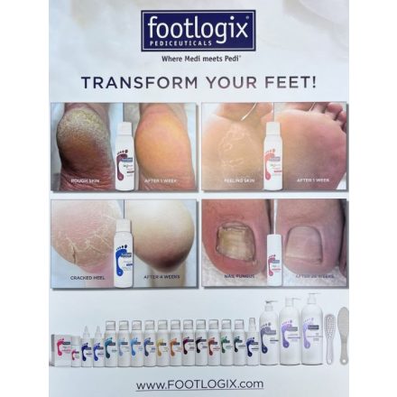 FOOTLOGIX POSZTER A3 "TRANSFORMATIONAL FOOTCARE"